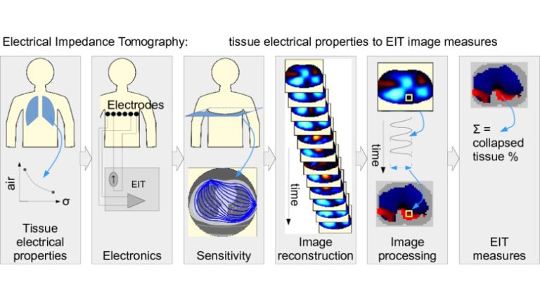 Bio-conductivity Measurement for Electrical Impedance Tomography (EIT) in Chronic Kidney Disease — A Non-invasive and Portable Monitoring Approach