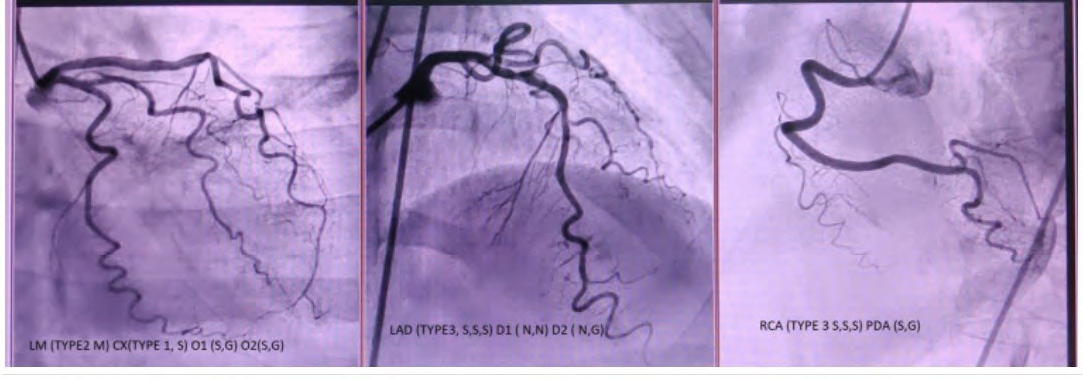 Proposed Novel Coronary Angiogram Reporting Format to Promote Uniformity