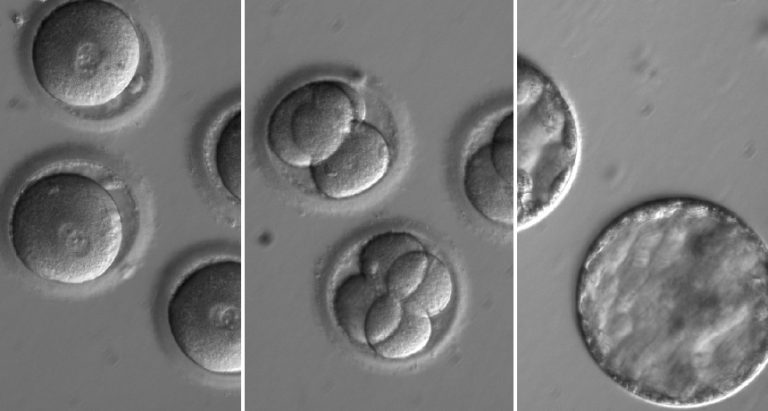 Researchers Urge Caution When Editing Genes in Early Human Embryos Due to The Possibility of Unanticipated and Hazardous Consequences-Additional Research Is Required to Refine Gene Editing Technology.
